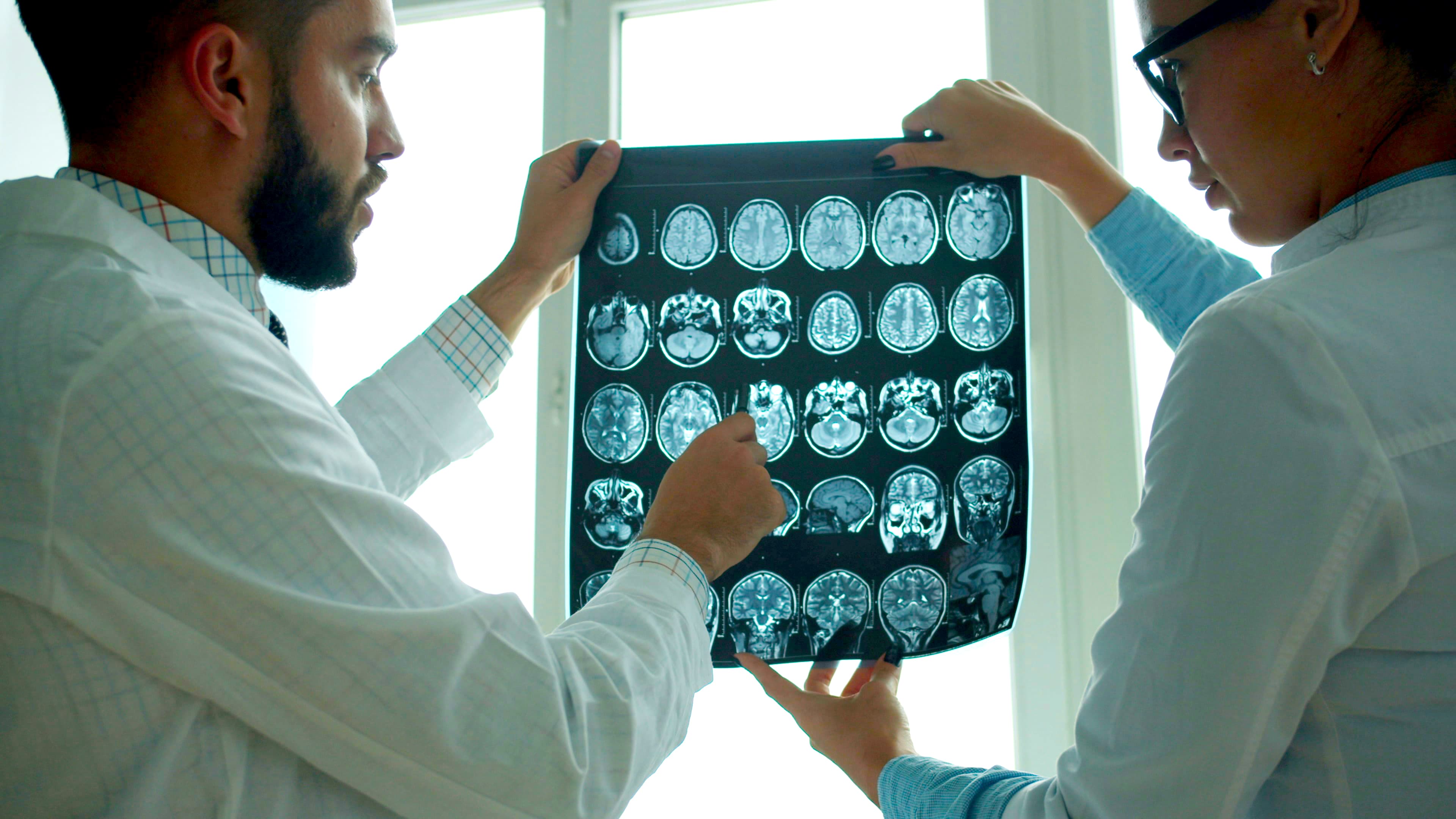 Brain MRI scan imagery